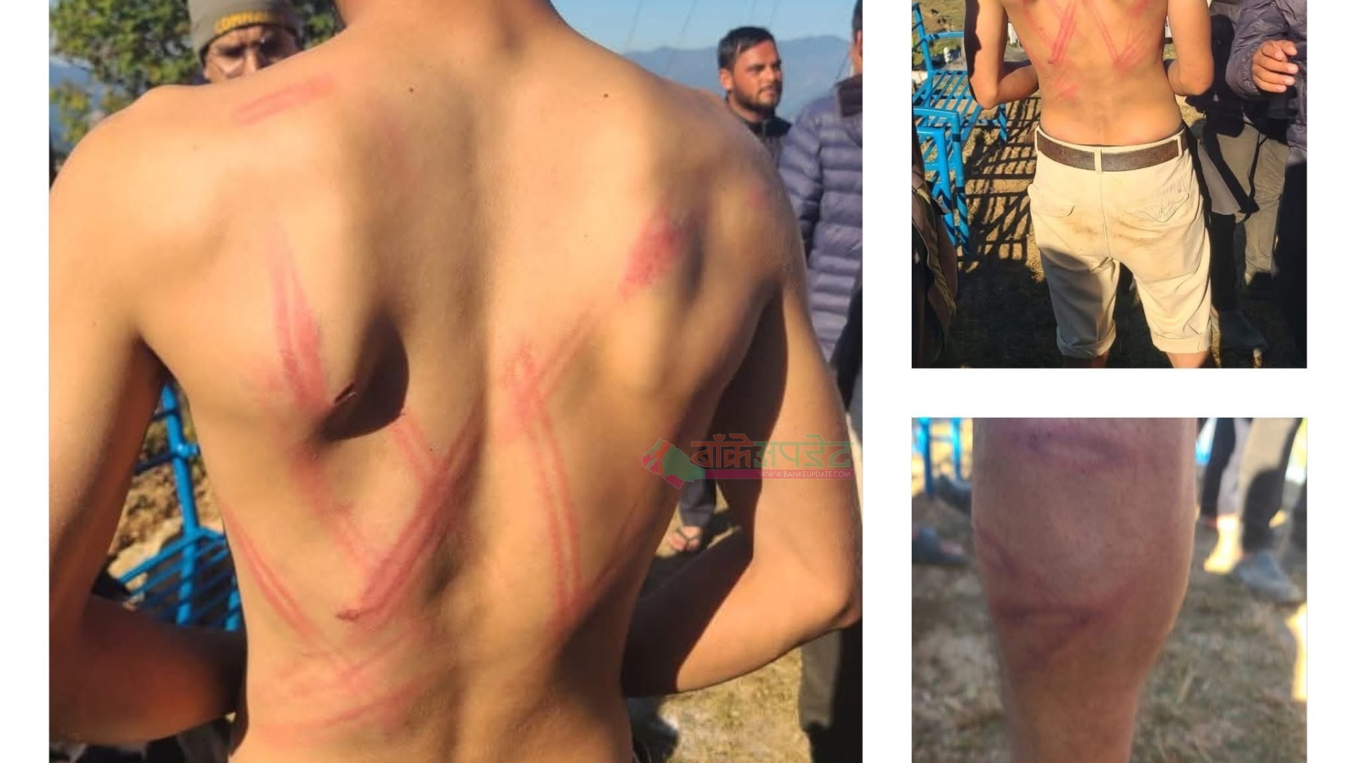 दैलेखमा प्रहरी चौकी इन्चार्जको कुटपिटबाट तीन युवक घाइते, इन्चार्जमाथी मदिरा सेवनको आरोप